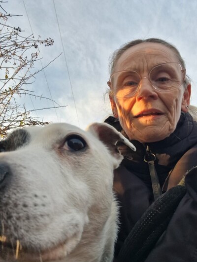Bury woman rebuilds life with NHS support after traumatic dog attack